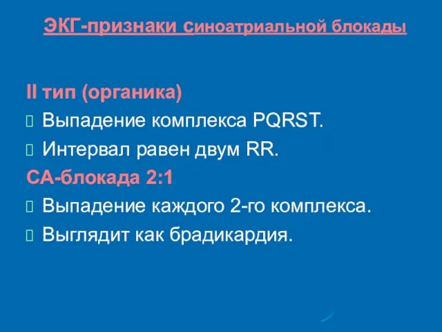 ЭКГ-признаки синоатриальной блокады II тип (органика)‏ Выпадение комплекса PQRST. Интервал равен