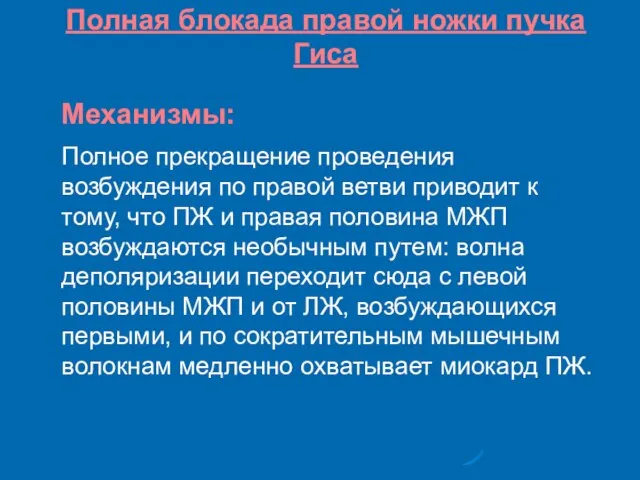 Полная блокада правой ножки пучка Гиса Механизмы: Полное прекращение проведения возбуждения