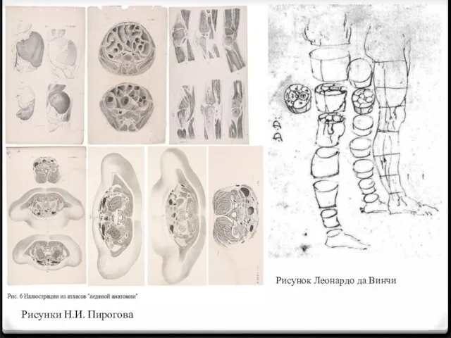 Рисунок Леонардо да Винчи Рисунки Н.И. Пирогова