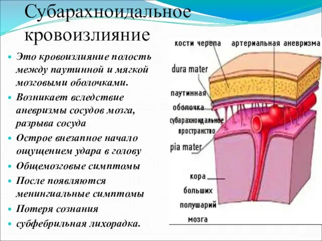 Субарахноидальное кровоизлияние Это кровоизлияние полость между паутинной и мягкой мозговыми оболочками.