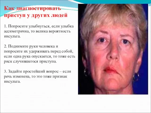 Как диагностировать приступ у других людей 1. Попросите улыбнуться, если улыбка