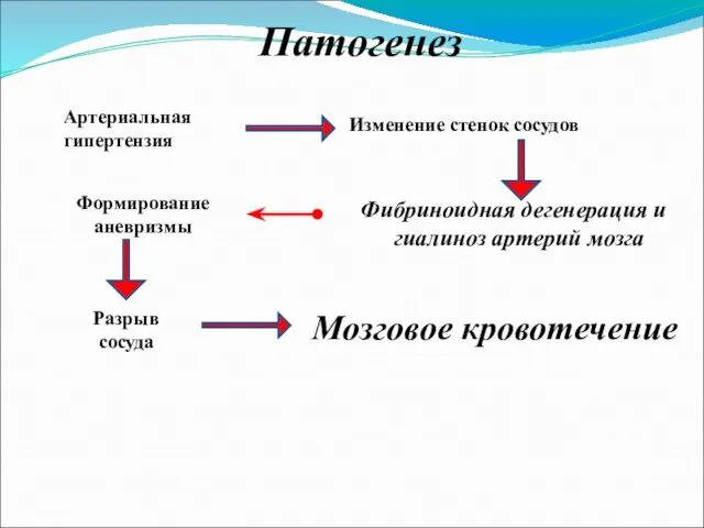 Артериальная гипертензия Изменение стенок сосудов Фибриноидная дегенерация и гиалиноз артерий мозга