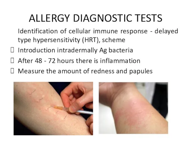 ALLERGY DIAGNOSTIC TESTS Identification of cellular immune response - delayed type