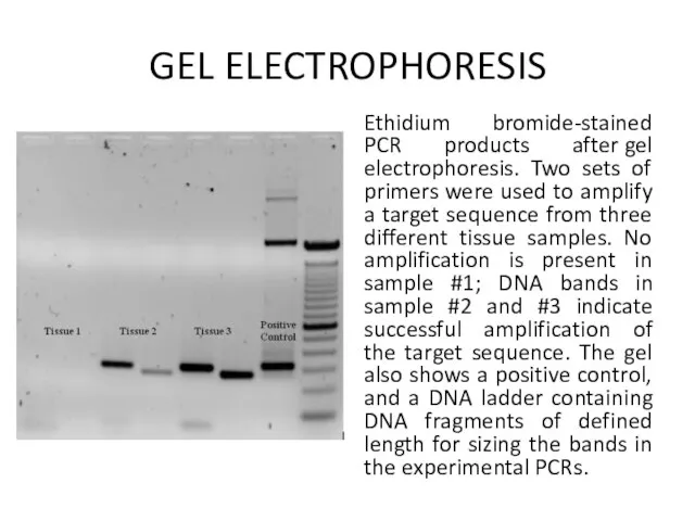 GEL ELECTROPHORESIS Ethidium bromide-stained PCR products after gel electrophoresis. Two sets