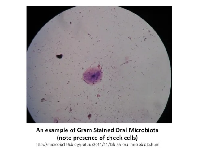 An example of Gram Stained Oral Microbiota (note presence of cheek cells) http://microbio146.blogspot.ru/2011/11/lab-35-oral-microbiota.html