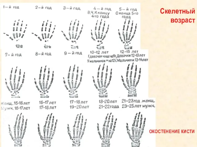 Скелетный возраст ОКОСТЕНЕНИЕ КИСТИ