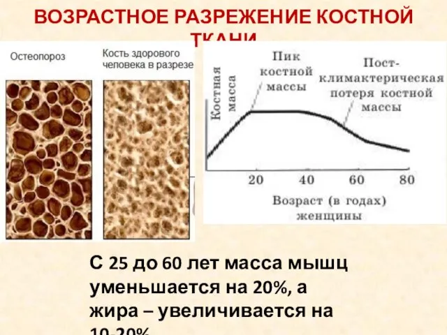 ВОЗРАСТНОЕ РАЗРЕЖЕНИЕ КОСТНОЙ ТКАНИ С 25 до 60 лет масса мышц