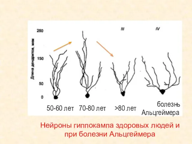 Нейроны гиппокампа здоровых людей и при болезни Альцгеймера 50-60 лет 70-80 лет >80 лет болезнь Альцгеймера