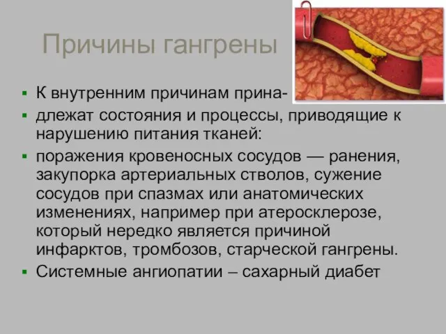 Причины гангрены К внутренним причинам прина- длежат состояния и процессы, приводящие