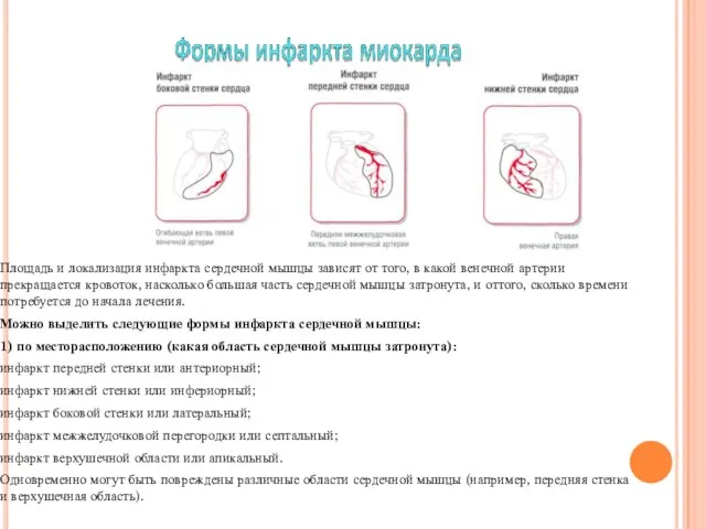 Площадь и локализация инфаркта сердечной мышцы зависят от того, в какой