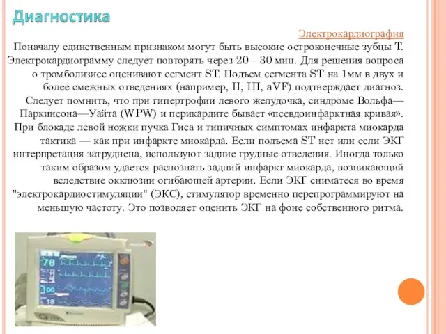 Электрокардиография Поначалу единственным признаком могут быть высокие остроконечные зубцы T. Электрокардиограмму