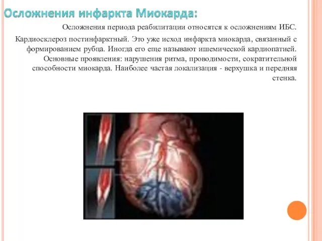 Осложнения периода реабилитации относятся к осложнениям ИБС. Кардиосклероз постинфарктный. Это уже