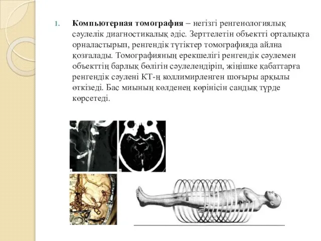 Компьютерная томография – негізгі ренгенологиялық сәулелік диагностикалық әдіс. Зерттелетін объектті орталықта