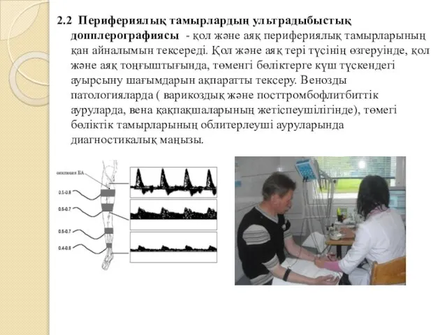 2.2 Перифериялық тамырлардың ультрадыбыстық допплерографиясы - қол және аяқ перифериялық тамырларының