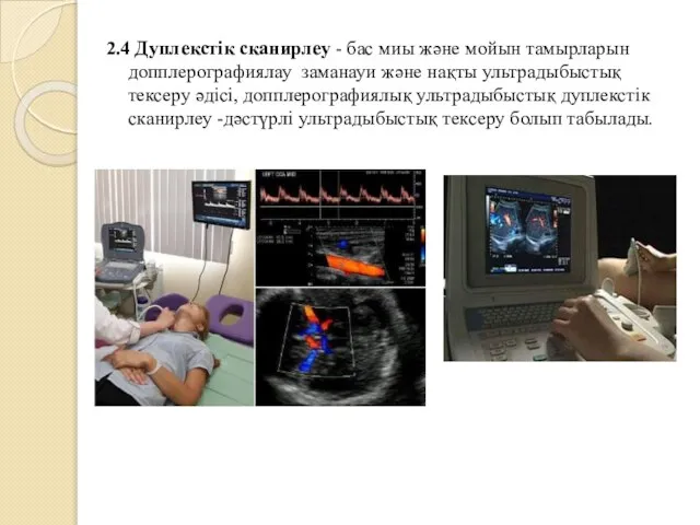 2.4 Дуплекстік сканирлеу - бас миы және мойын тамырларын допплерографиялау заманауи