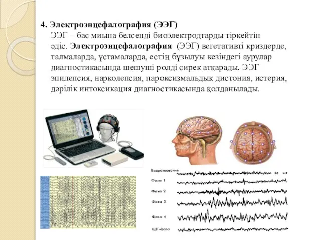 4. Электроэнцефалография (ЭЭГ) ЭЭГ – бас миына белсенді биоэлектродтарды тіркейтін әдіс.