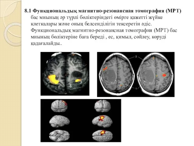 8.1 Функциональдық магнитно-резонансная томография (МРТ) бас миының әр түрлі бөліктеріндегі өмірге