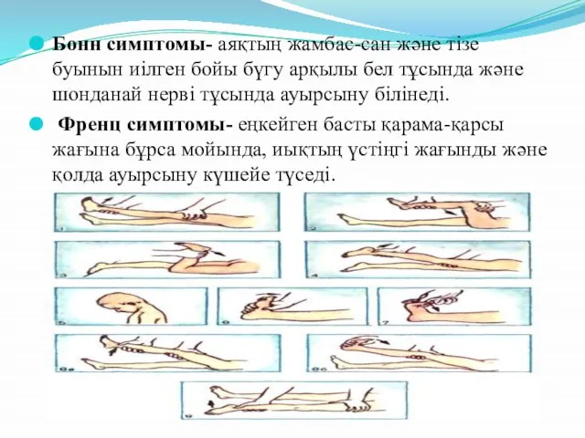 Бонн симптомы- аяқтың жамбас-сан және тізе буынын иілген бойы бүгу арқылы