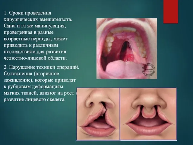 1. Сроки проведения хирургических вмешательств. Одна и та же манипуляция, проведенная