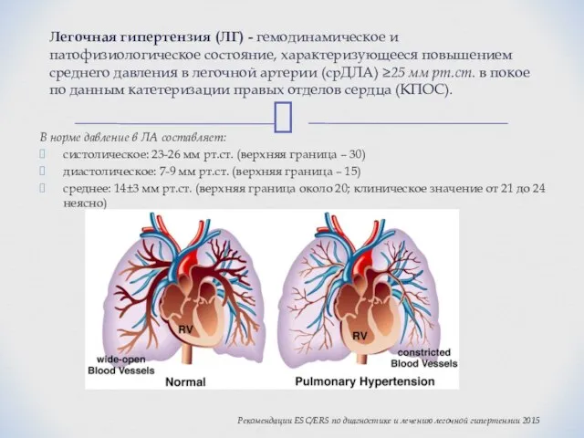 В норме давление в ЛА составляет: систолическое: 23-26 мм рт.ст. (верхняя