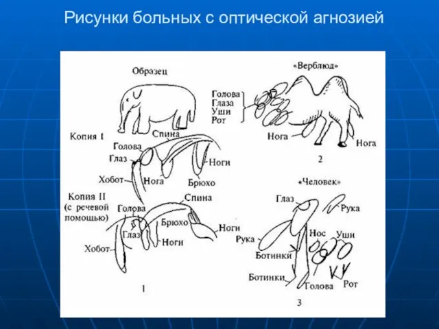 Рисунки больных с оптической агнозией