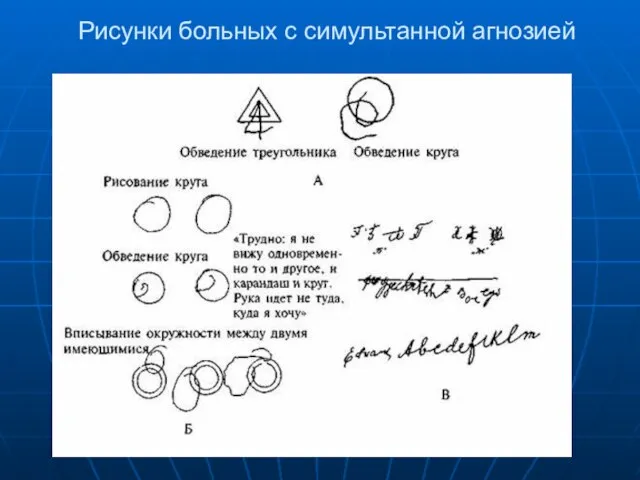 Рисунки больных с симультанной агнозией