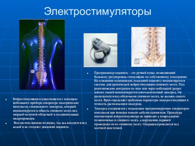 Электростимуляторы Нейростимуляция осуществляется с помощью небольшого прибора-генератора электрических импульсов, специального электрода,