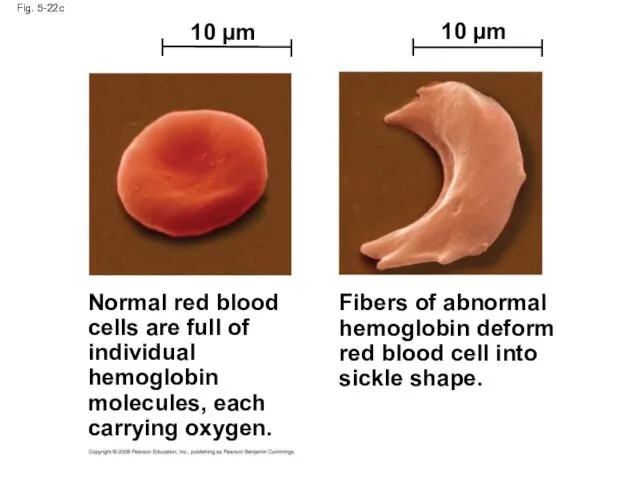 Fig. 5-22c Normal red blood cells are full of individual hemoglobin