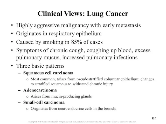 Clinical Views: Lung Cancer Highly aggressive malignancy with early metastasis Originates