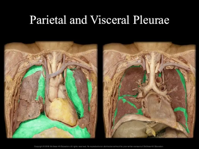 Parietal and Visceral Pleurae