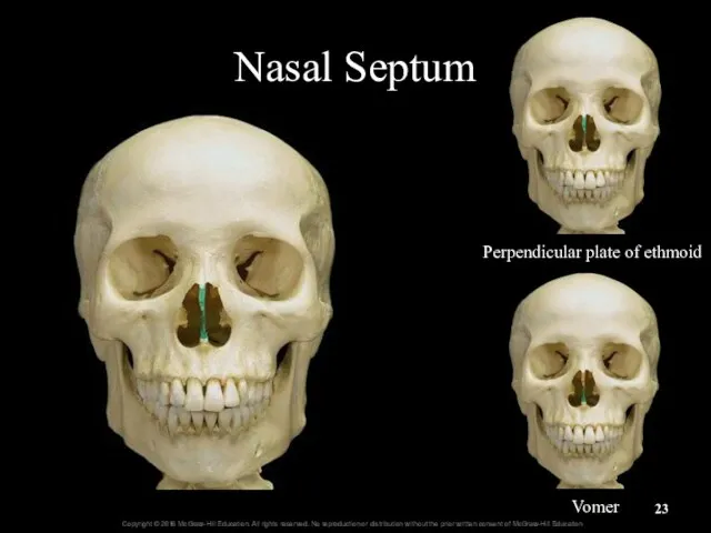 Nasal Septum Perpendicular plate of ethmoid Vomer