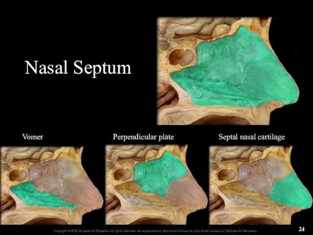 Nasal Septum Vomer Perpendicular plate Septal nasal cartilage