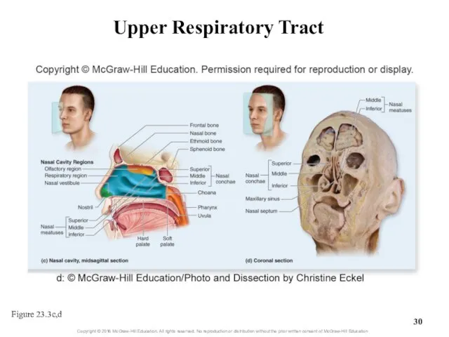 Upper Respiratory Tract Figure 23.3c,d