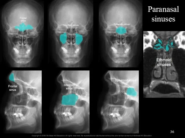 Paranasal sinuses