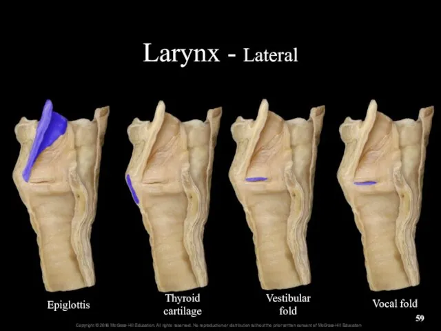 Larynx - Lateral Epiglottis Thyroid cartilage Vestibular fold Vocal fold