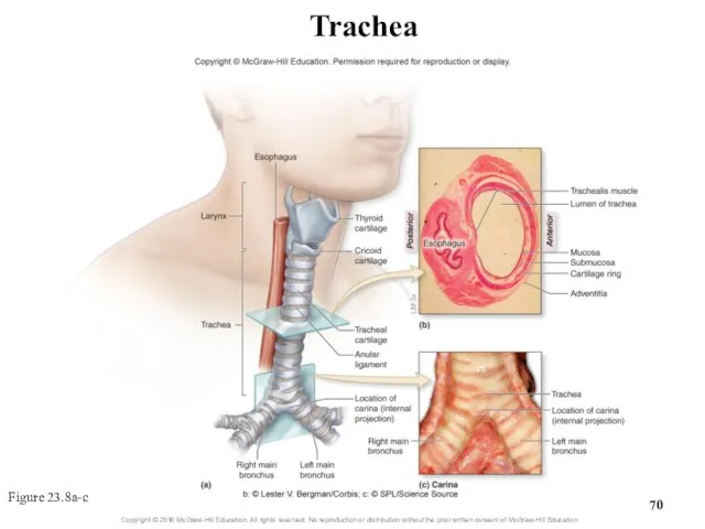 Trachea Figure 23.8a-c