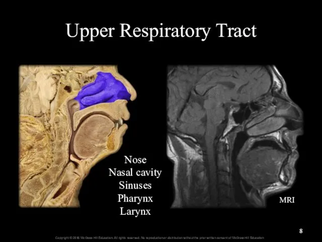 Upper Respiratory Tract Nose Nasal cavity Sinuses Pharynx Larynx MRI