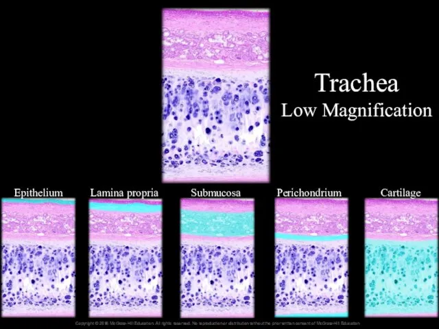 Trachea Low Magnification Epithelium Lamina propria Submucosa Perichondrium Cartilage