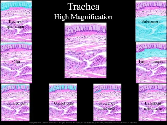 Trachea High Magnification Tracheal epithelium Cilia Ciliated cells Goblet cells Nuclei