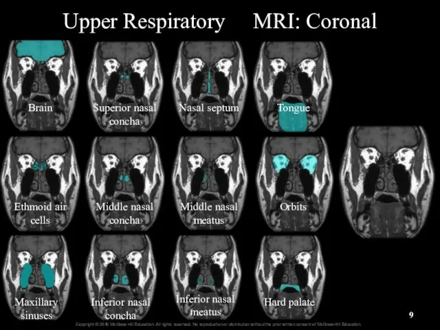 Upper Respiratory MRI: Coronal Brain Ethmoid air cells Maxillary sinuses Superior