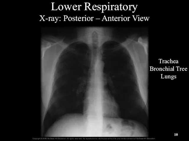 Lower Respiratory X-ray: Posterior – Anterior View Trachea Bronchial Tree Lungs