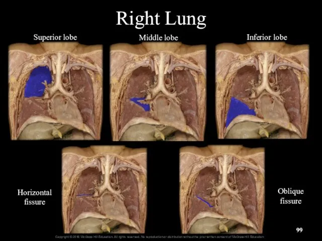 Right Lung Superior lobe Middle lobe Inferior lobe Horizontal fissure Oblique fissure