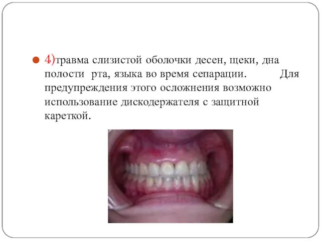 4)травма слизистой оболочки десен, щеки, дна полости рта, языка во время