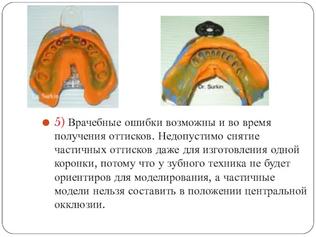 5) Врачебные ошибки возможны и во время получения оттисков. Недопустимо снятие