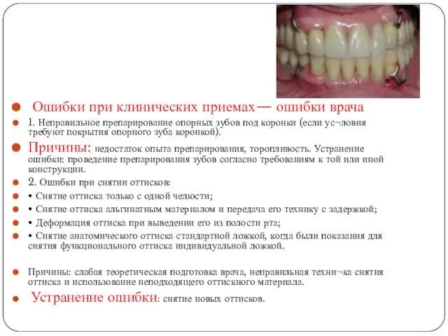 Ошибки при клинических приемах— ошибки врача 1. Неправильное препарирование опорных зубов