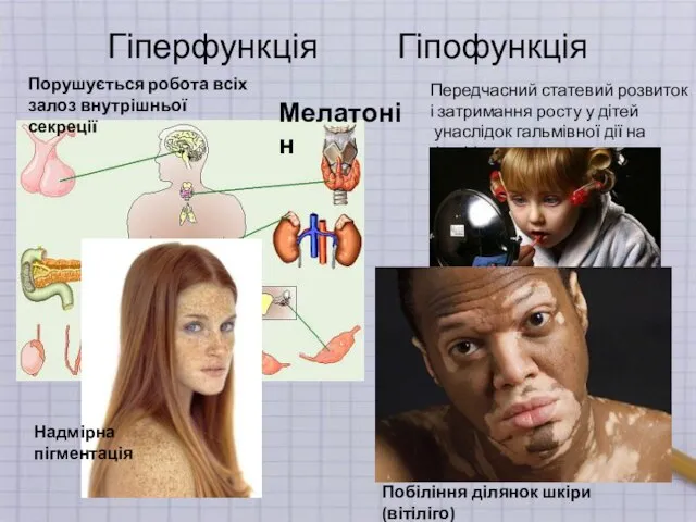 Гіперфункція Гіпофункція Мелатонін Порушується робота всіх залоз внутрішньої секреції Передчасний статевий