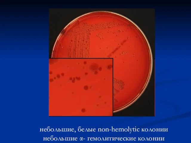 небольшие, белые non-hemolytic колонии небольшие α- гемолитические колонии