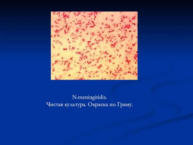 N.meningitidis. Чистая культура. Окраска по Граму.