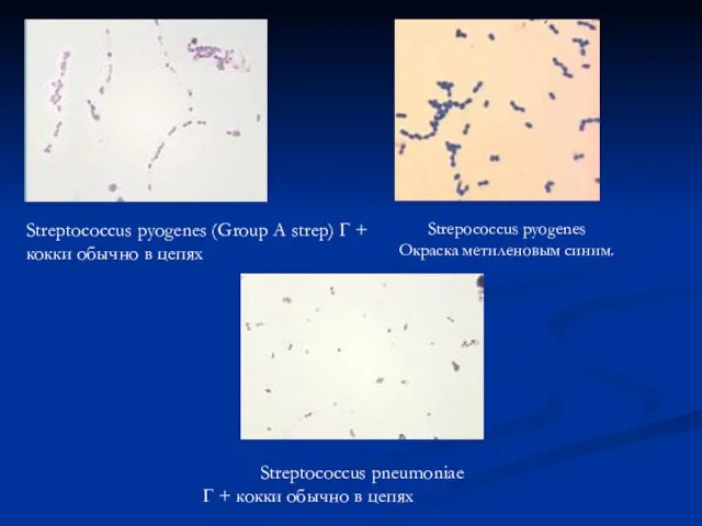 Streptococcus pyogenes (Group A strep) Г + кокки обычно в цепях