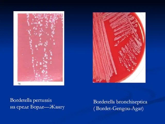 Bordetella pertussis на среде Борде—Жангу Bordetella bronchiseptica ( Bordet-Gengou-Agar)